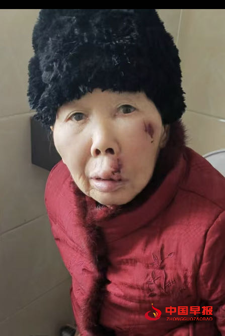 1735026247142459.png 888.png