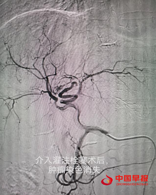 1762388212107892.png 222.png